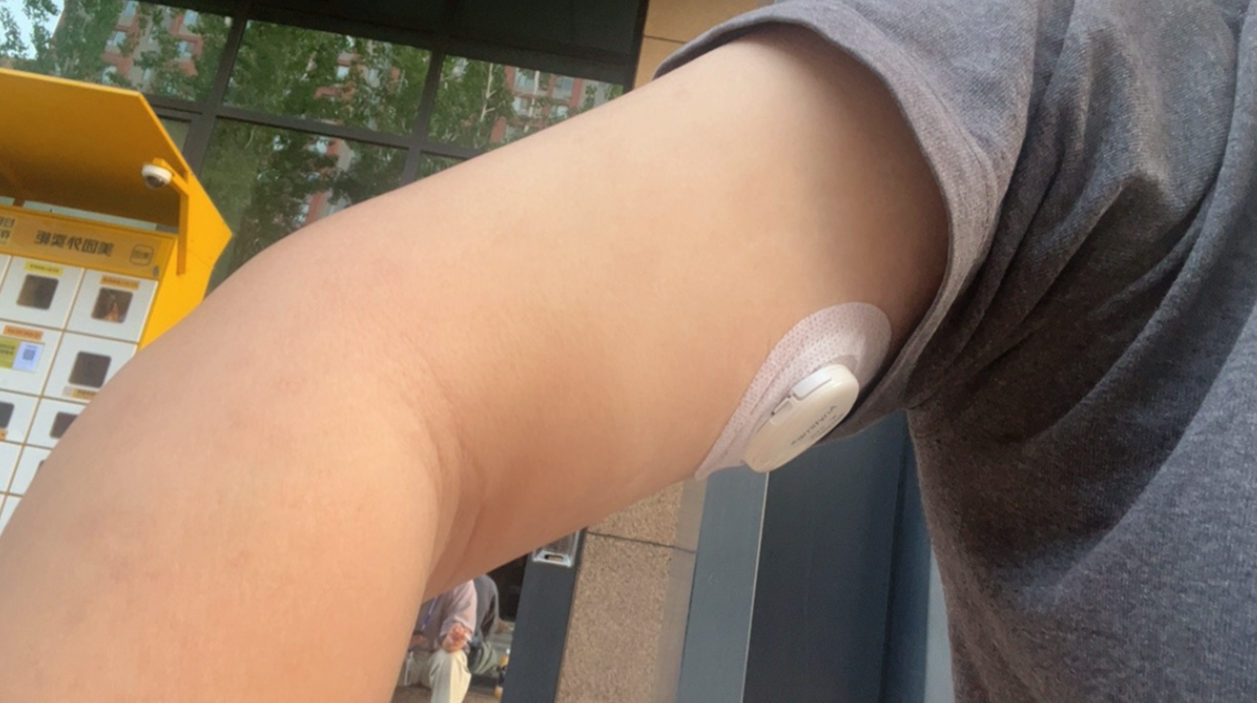 鱼跃 Anytime CT 15 血糖监测仪体验 & 个人心得分享 - 8 d2b5ca33bd970f64a6301fa75ae2eb22 10