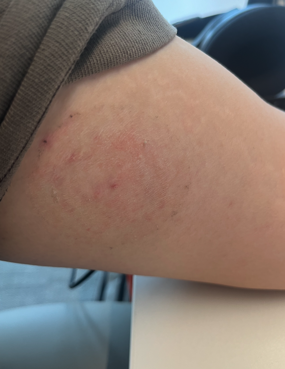 鱼跃 Anytime CT 15 血糖监测仪体验 & 个人心得分享 - 15 d2b5ca33bd970f64a6301fa75ae2eb22 17